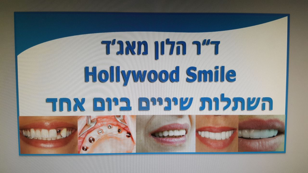 דר מאגד הלון שובר שיאים !!