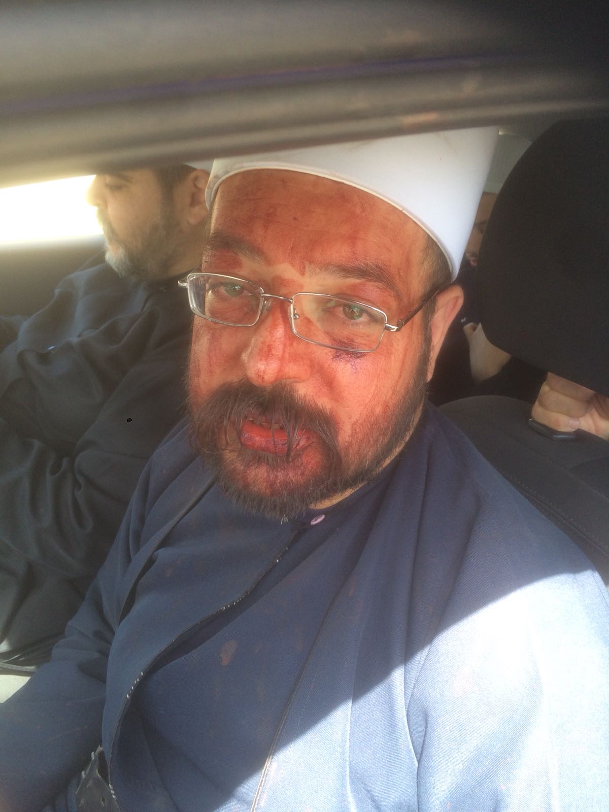 شجار بالايادي في مقام النبي الخضر واصابة شخصين